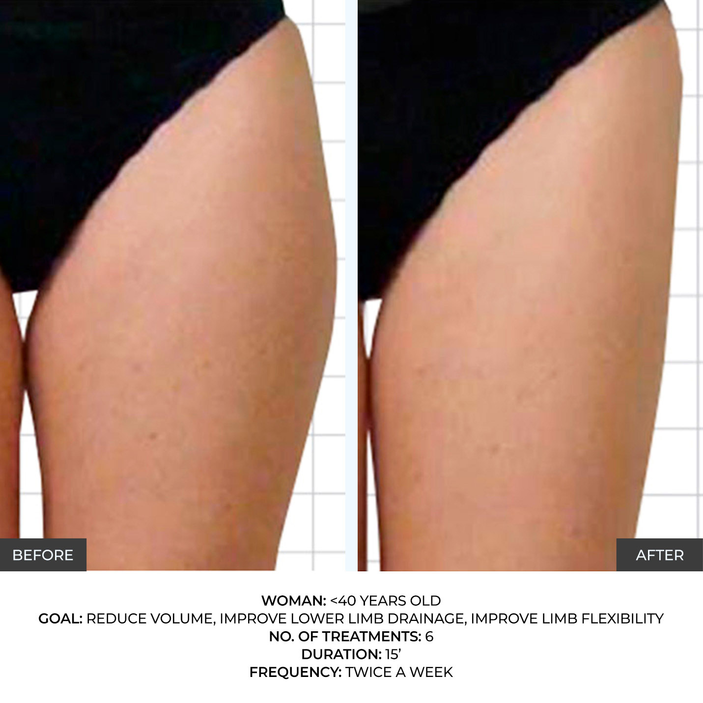 before-after-1