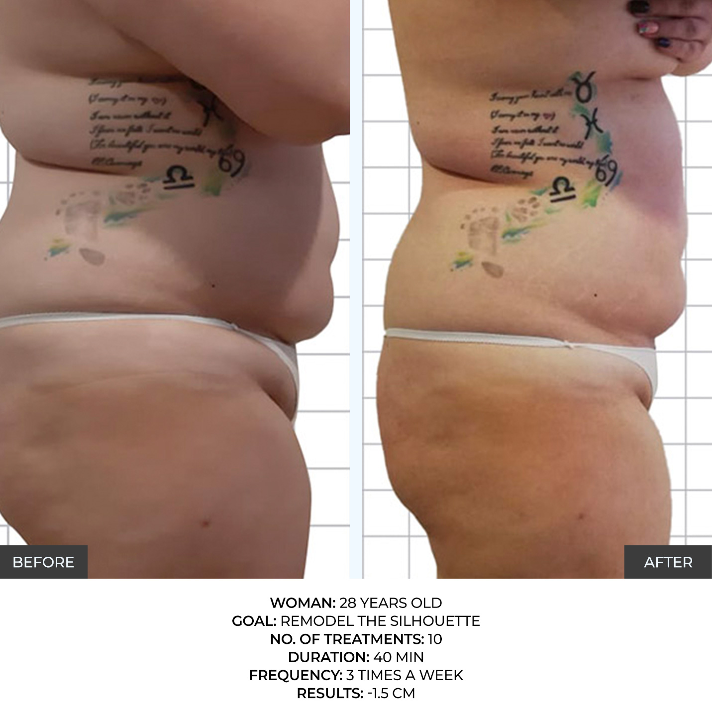 before-after-10