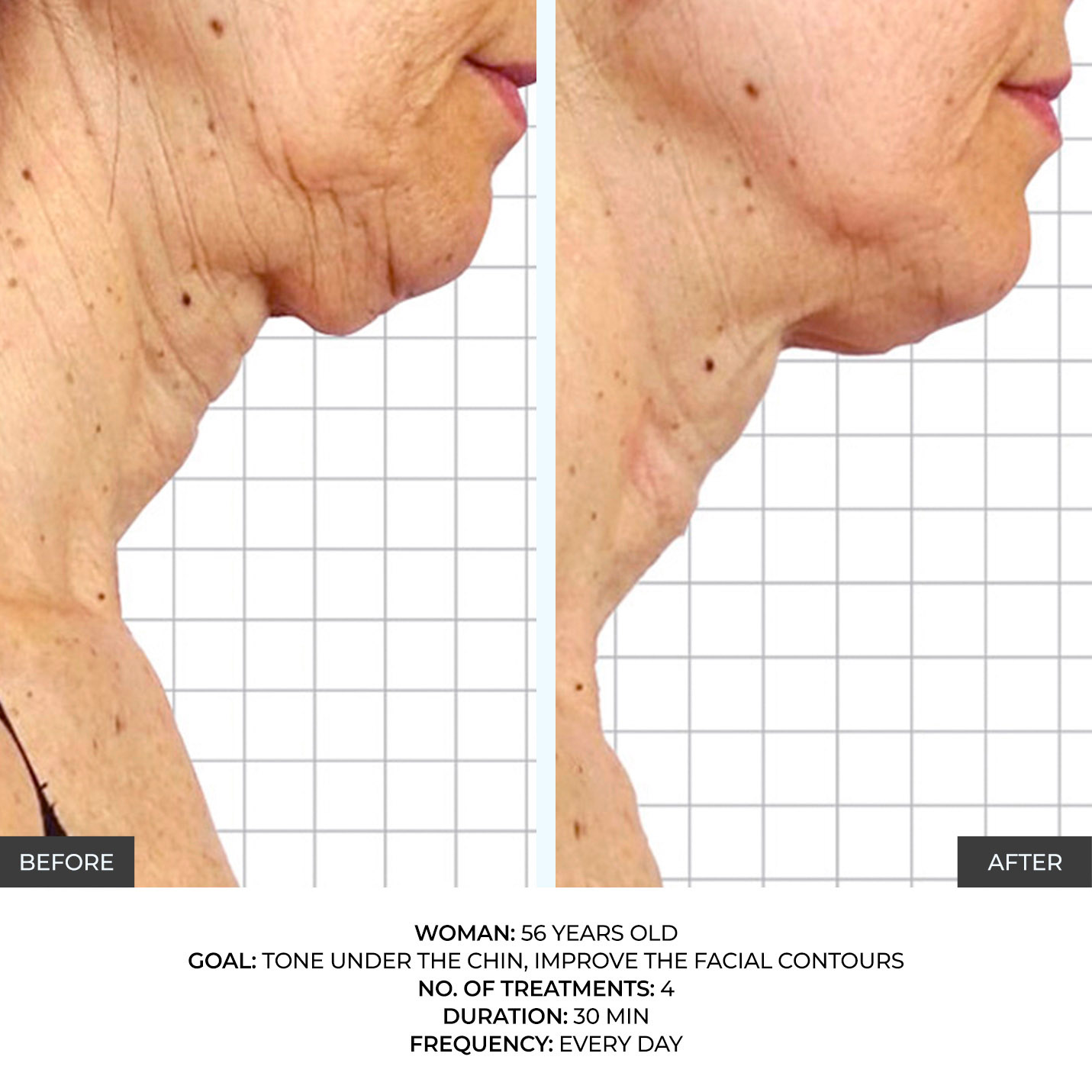 before-after