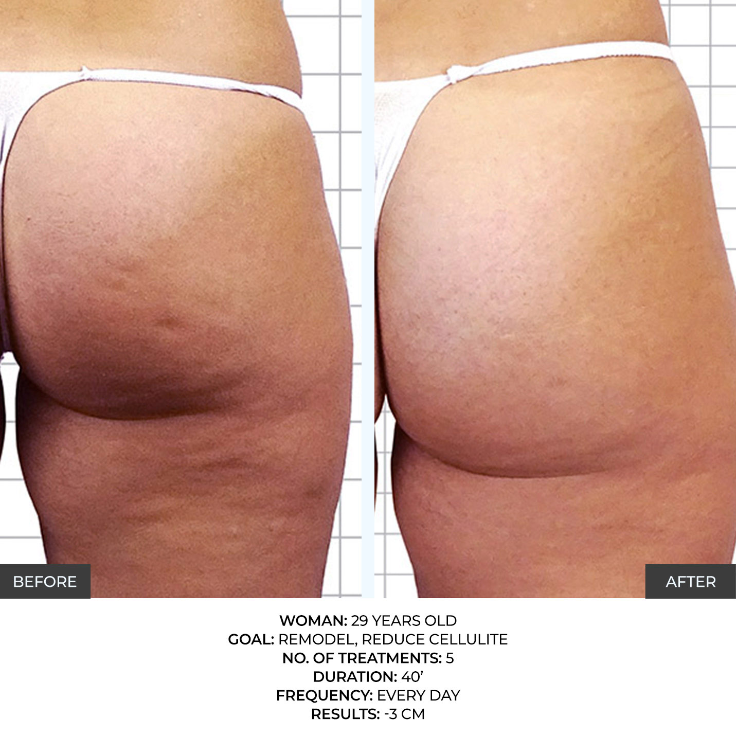 before-after-2