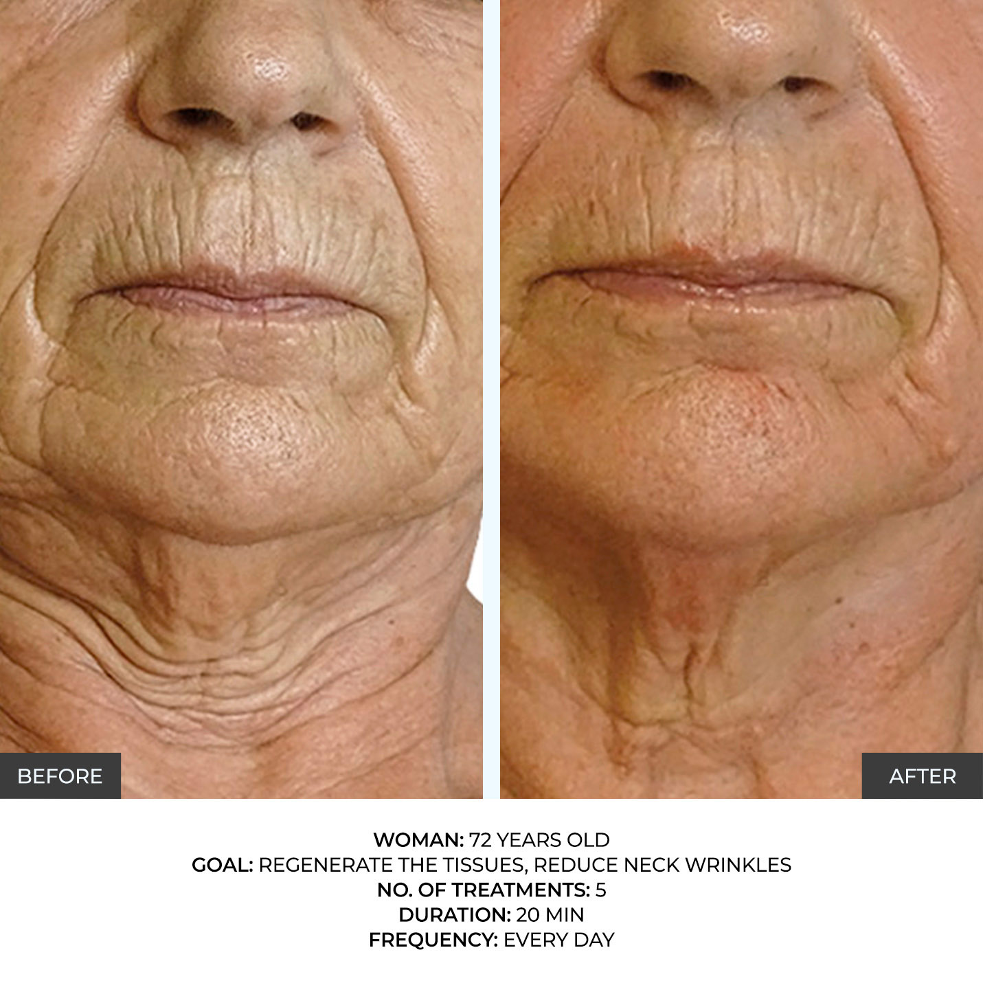 before-after-2