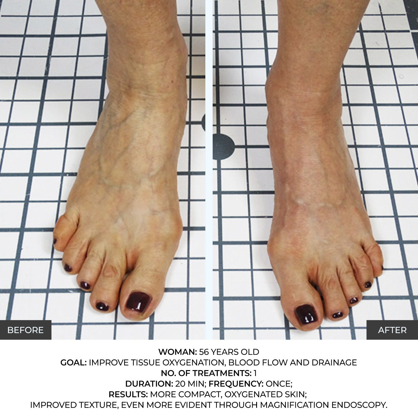 before-after-3