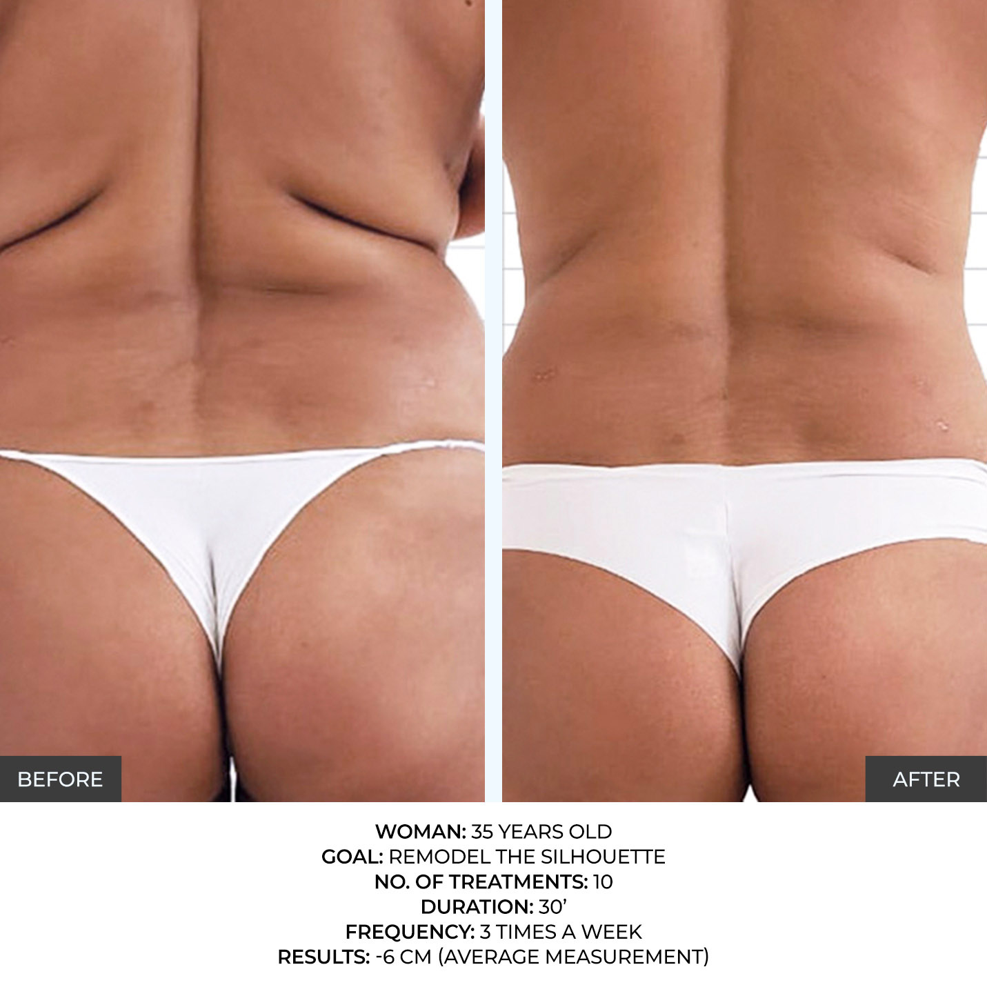 before-after-4