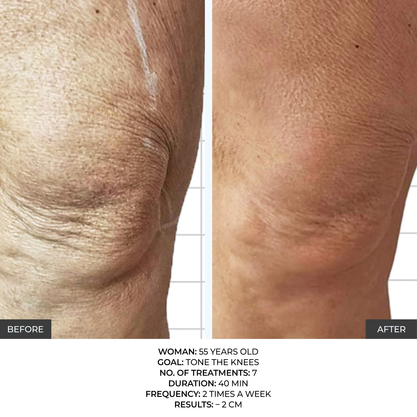 before-after-5