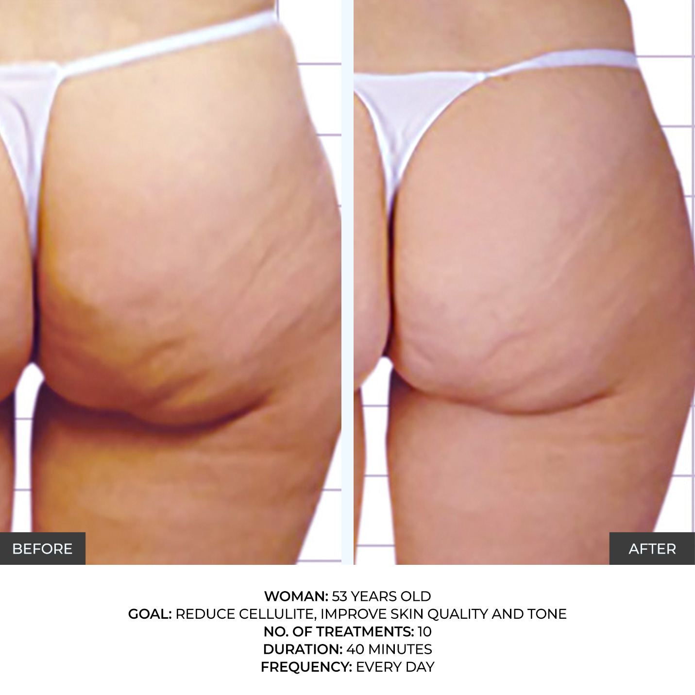 before-after-6