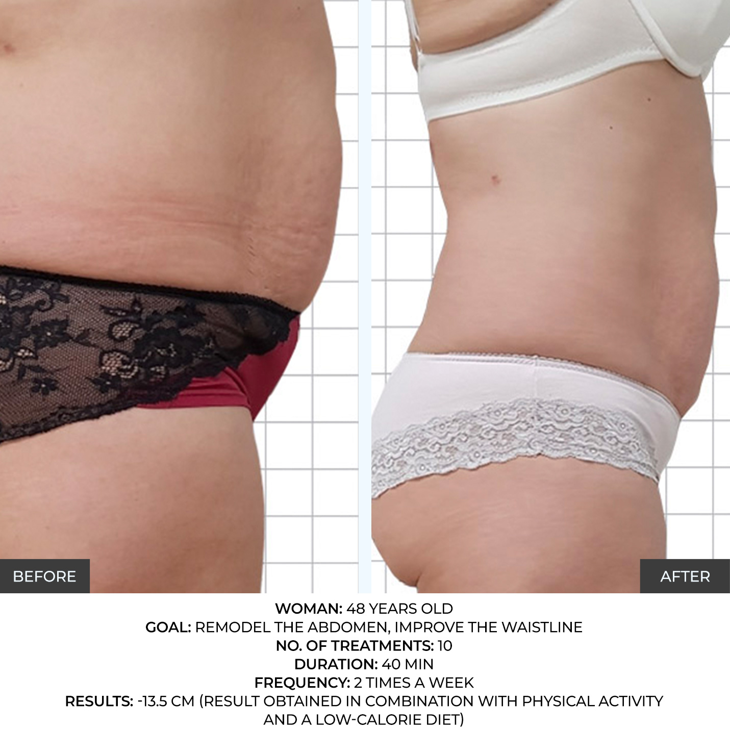 before-after-7