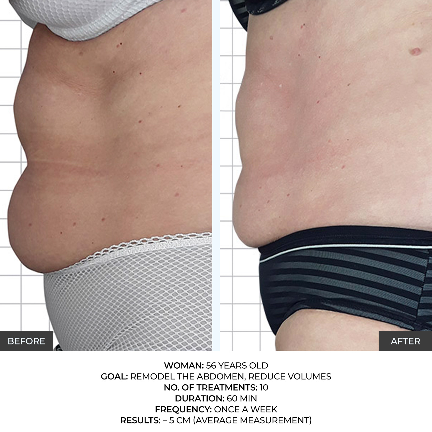 before-after-8