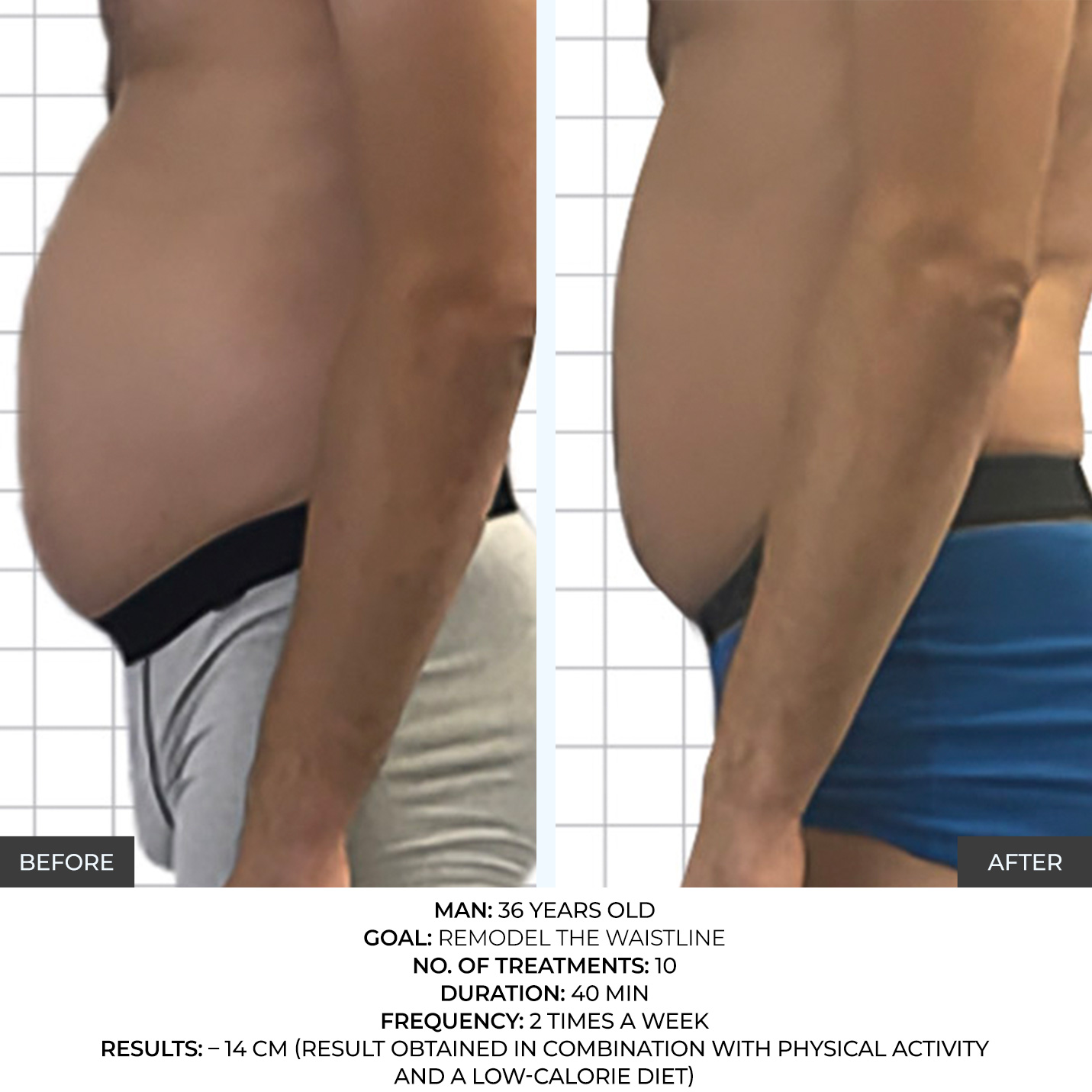 before-after-9